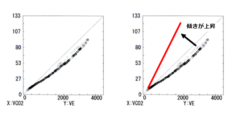 VE/VCO2 slopeのグラフの画像